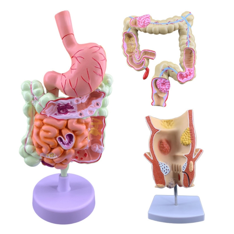 Medical Lab Observer - Q6PA 3D-Pathologie-Lehrmodell, PVC-Anatomie-Display für Laborbeobachtung, Erklärung
